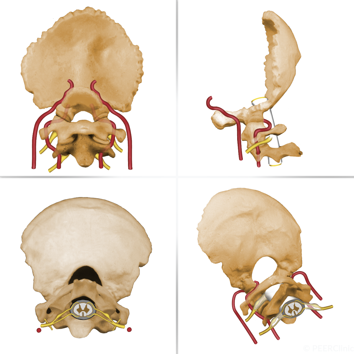 Three bones of the occipital cervical-junction